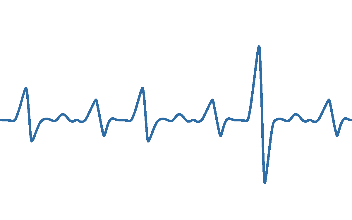 ekg